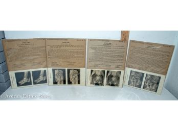 Set Of Four - Edinburgh University Stereoscopic Anatomy  Stereoviews - Shipping Available