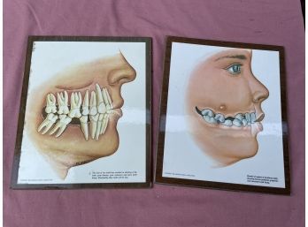 Pair Of 1966 American Dental Association Medical Tooth Illustrations, Diagrams